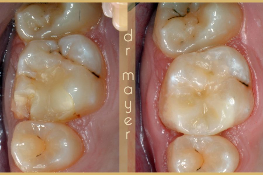fogszabályozás Budapest